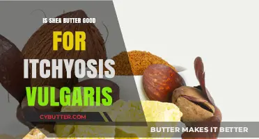 Shea Butter Benefits for Itchy, Scaly Ichthyosis Vulgaris Skin Relief
