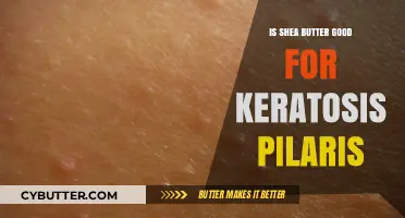 Shea Butter Benefits: Effective Treatment for Keratosis Pilaris Skin?