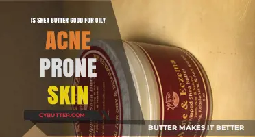 Shea Butter Benefits: Can It Help Oily, Acne-Prone Skin?