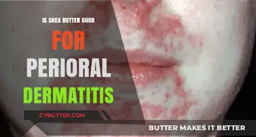 Shea Butter and Perioral Dermatitis: Benefits, Risks, and Best Practices