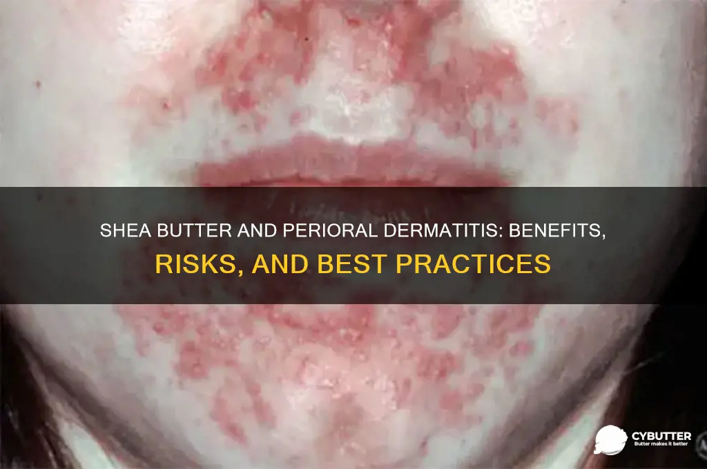 is shea butter good for perioral dermatitis