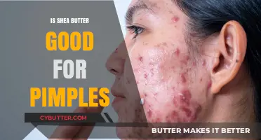 Shea Butter for Acne: Benefits, Uses, and Pimple-Fighting Properties