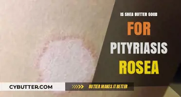 Shea Butter Benefits: Effective Relief for Pityriasis Rosea Symptoms?