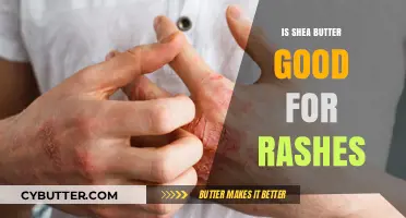 Shea Butter for Rashes: Benefits, Uses, and Effective Relief Tips