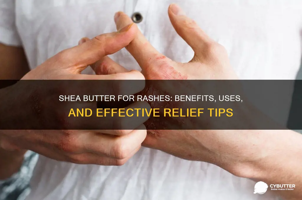 is shea butter good for rashes