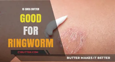 Shea Butter for Ringworm: Effective Natural Remedy or Myth?