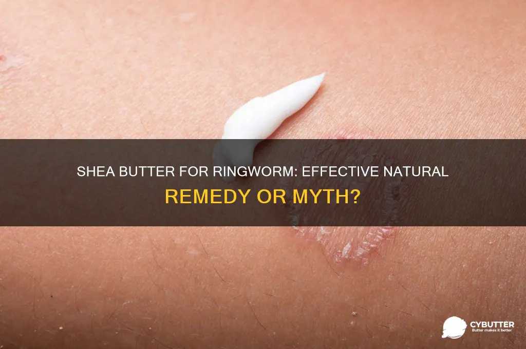 is shea butter good for ringworm