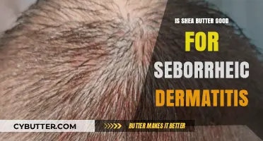 Shea Butter Benefits: Effective Relief for Seborrheic Dermatitis?