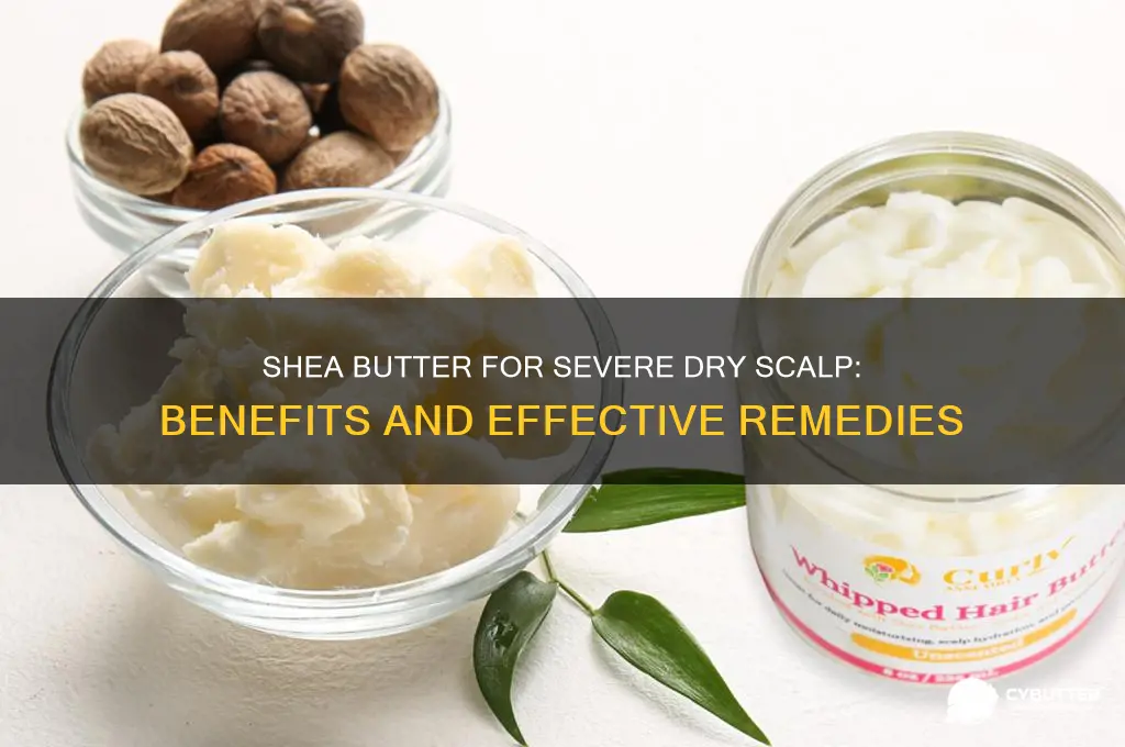 is shea butter good for severely dry scalp