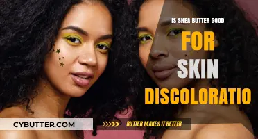 Shea Butter Benefits: Can It Even Out Skin Discoloration?