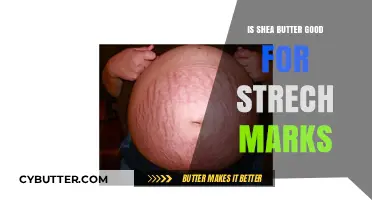 Shea Butter for Stretch Marks: Effective Solution or Just Hype?