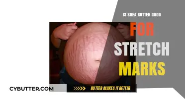 Shea Butter for Stretch Marks: Effective Solution or Just a Myth?