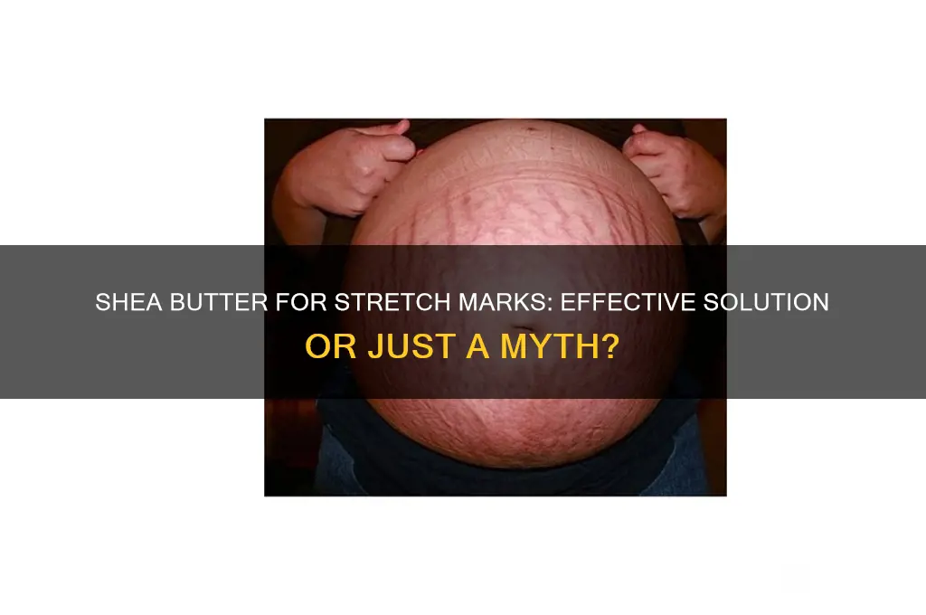 is shea butter good for stretch marks