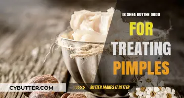 Shea Butter for Acne: Effective Pimple Treatment or Myth?