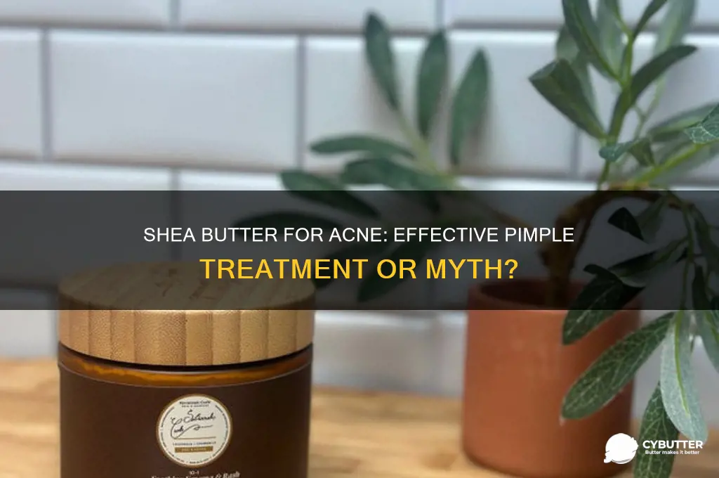 is shea butter good for treating pimples