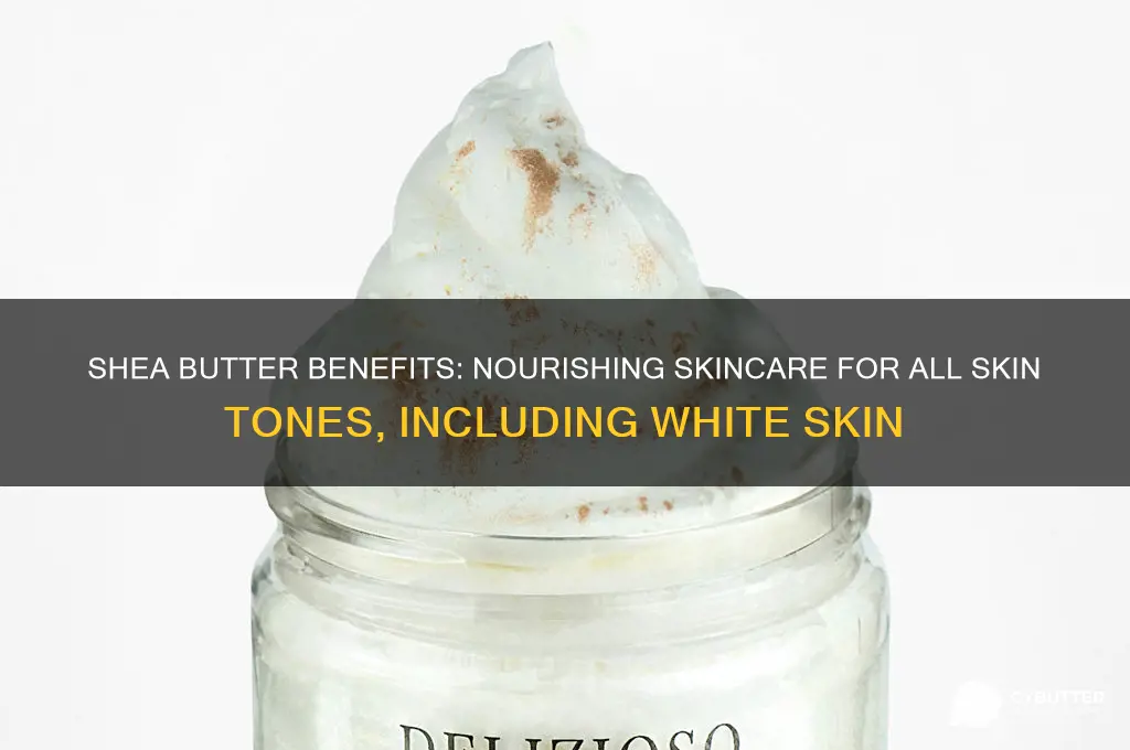 is shea butter good for white skin