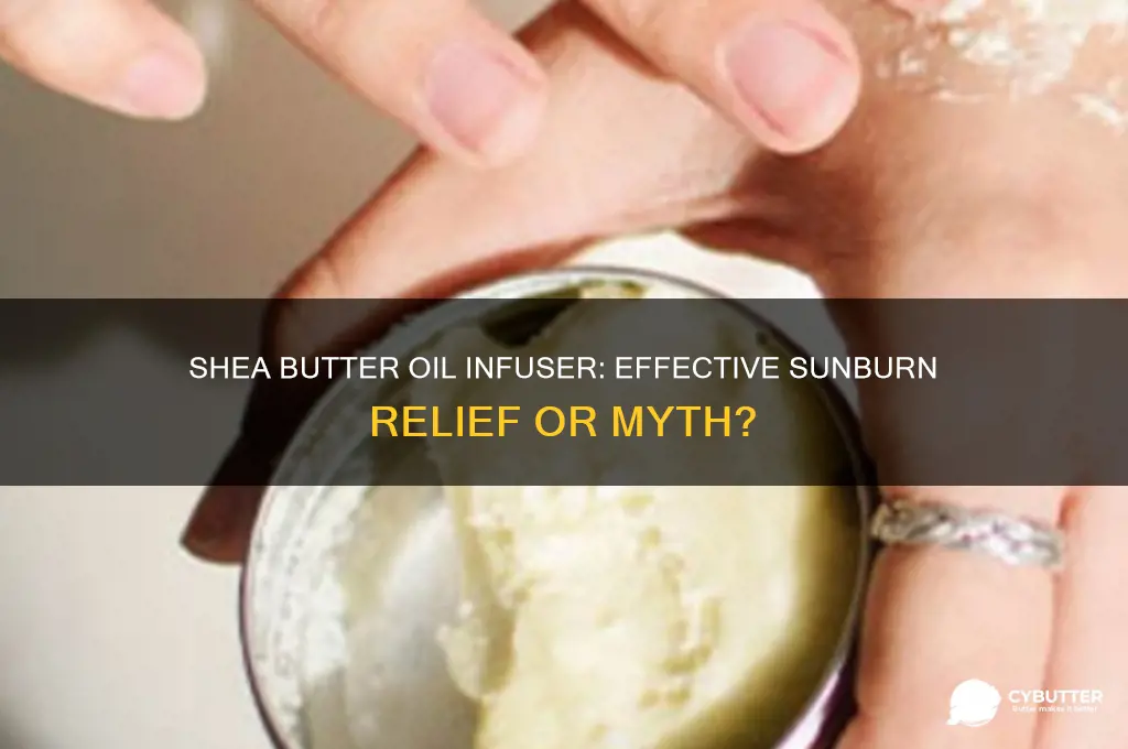 is shea butter oil infuser good for sunburns