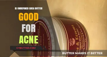 Unrefined Shea Butter for Acne: Benefits, Uses, and Effectiveness Explained