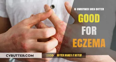Unrefined Shea Butter Benefits: A Natural Remedy for Eczema Relief?