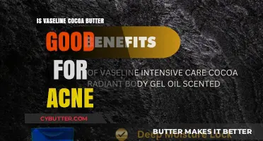 Vaseline Cocoa Butter for Acne: Benefits, Risks, and Best Practices