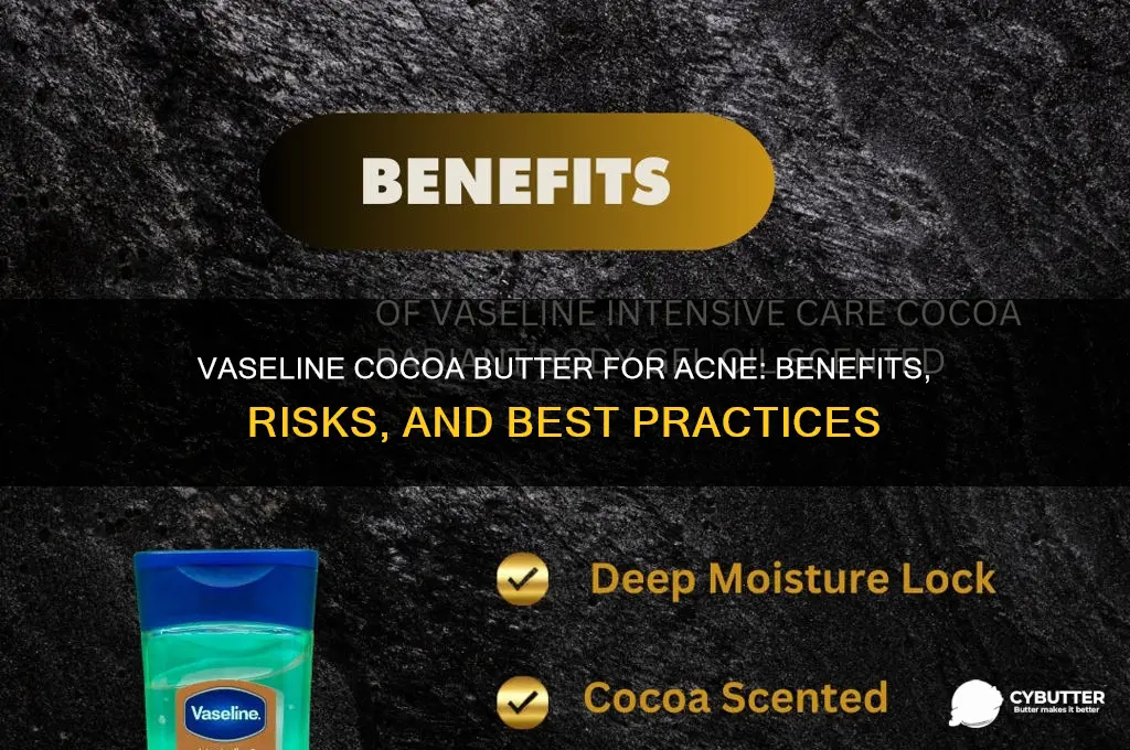 is vaseline cocoa butter good for acne
