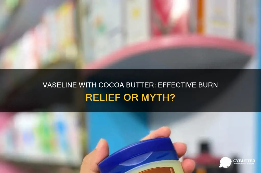 is vaseline with cocoa butter good for burns