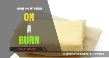 The Surprising Truth About Butter on Burns: A Myth Busted