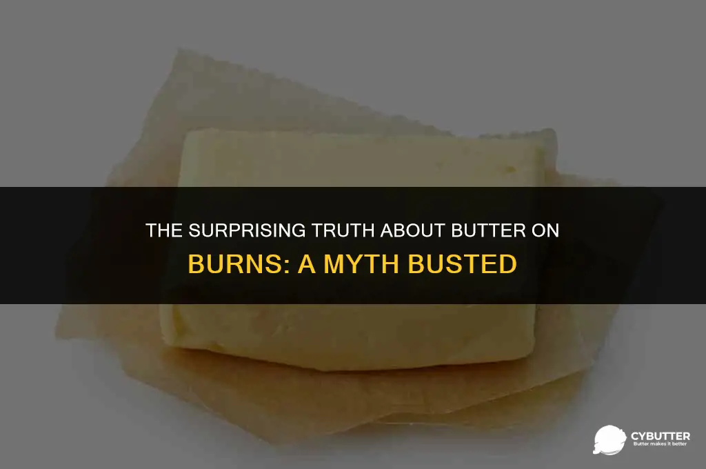 should you put butter on a burn