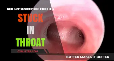Peanut Butter Stuck in Throat: Causes, Risks, and Quick Remedies