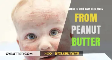 Baby Hives from Peanut Butter: Quick Steps to Calm and Care