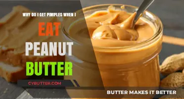 Peanut Butter and Pimples: Unraveling the Skin-Food Connection