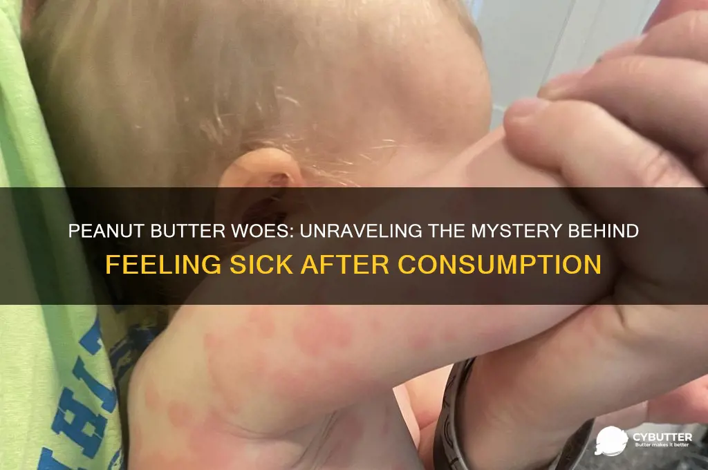 why do i get sick when i eat peanut butter