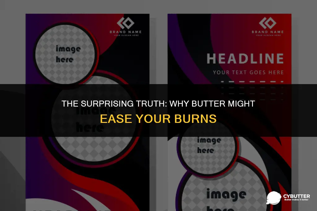 why do they say butter is good for burns