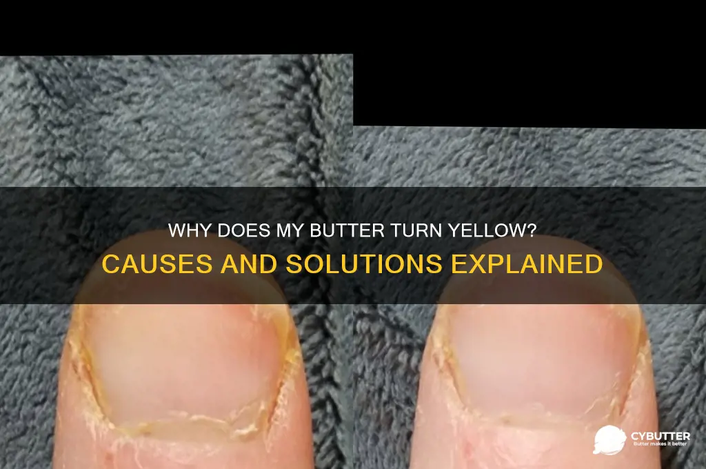 why does my butter get yellow outside