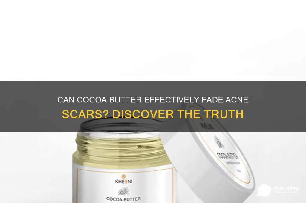 will cocoa butter get rid of acne scars