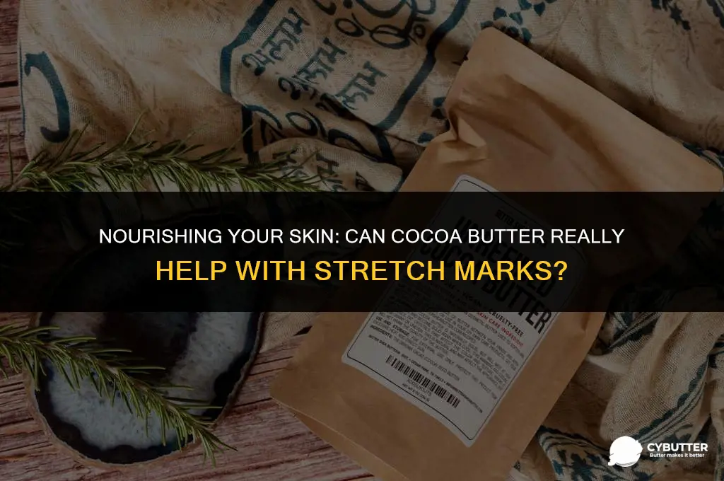 will cocoa butter help with stretch marks