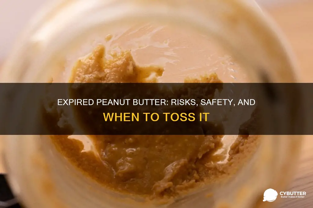 will i get sick from expired peanut butter
