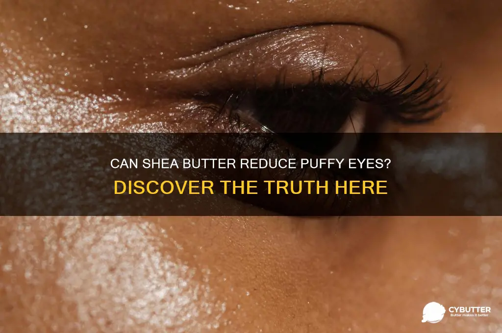 will shea butter get rid of my puffy eyes