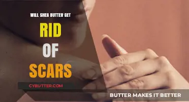Can Shea Butter Fade Scars? Discover the Healing Potential