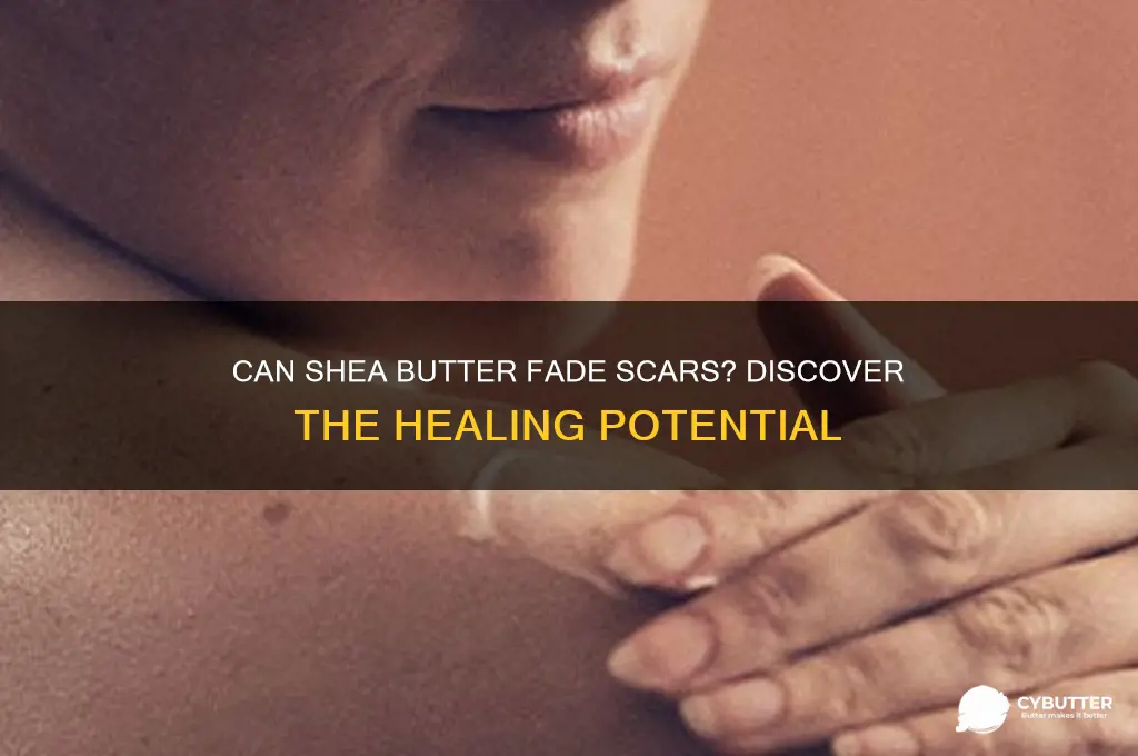 will shea butter get rid of scars