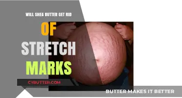 Can Shea Butter Effectively Fade Stretch Marks? A Comprehensive Guide
