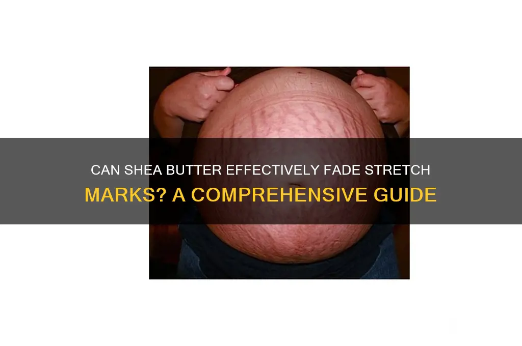 will shea butter get rid of stretch marks